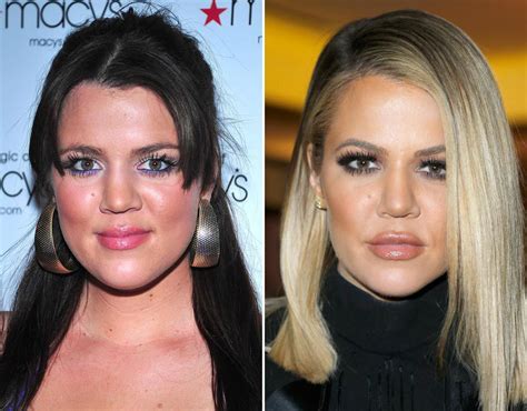 khloe kardashian face change.